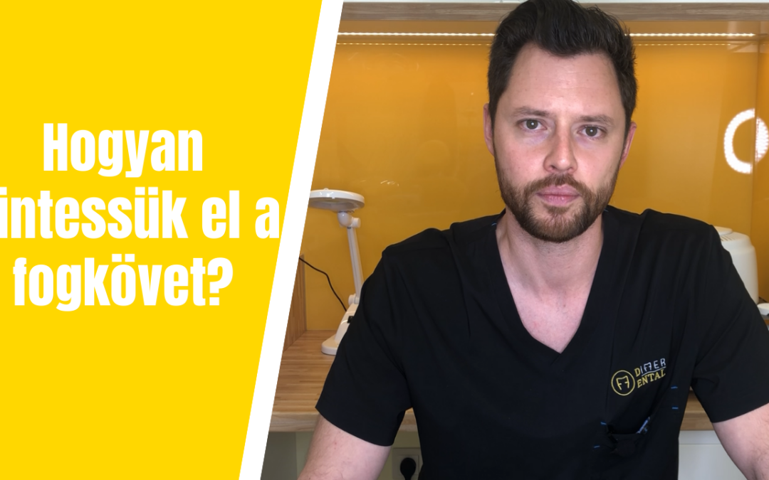 Hogyan tüntessük el a fogkövet?