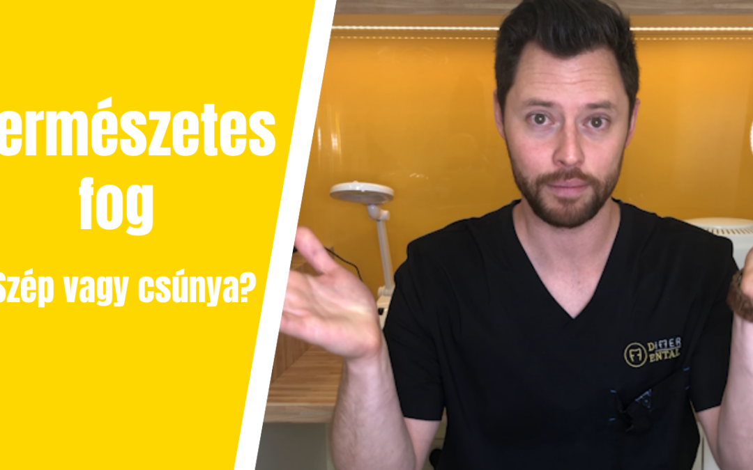 A természetes fog szép vagy csúnya?