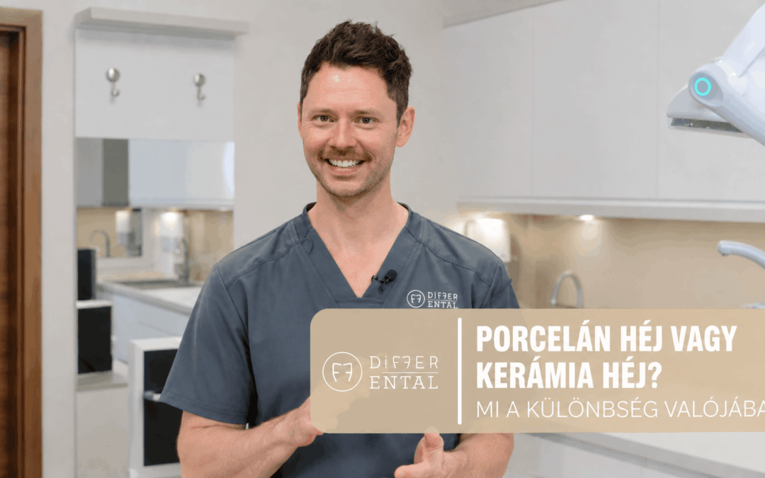 Porcelán héj vagy kerámia héj? Mi a különbség valójában?