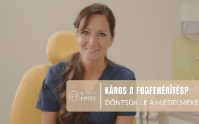 Valóban káros a fogfehérítés? – Döntsük meg a hiedelmeket!